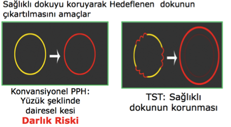Doku secici teknoloji